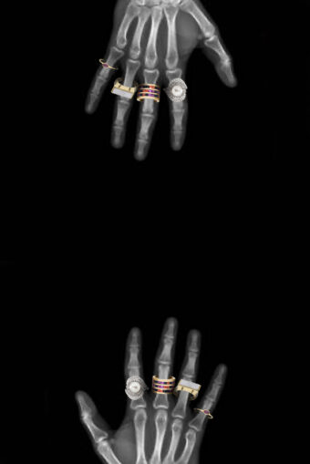 skeleton hands with jewellery